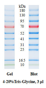 SDS-PAGE band profile